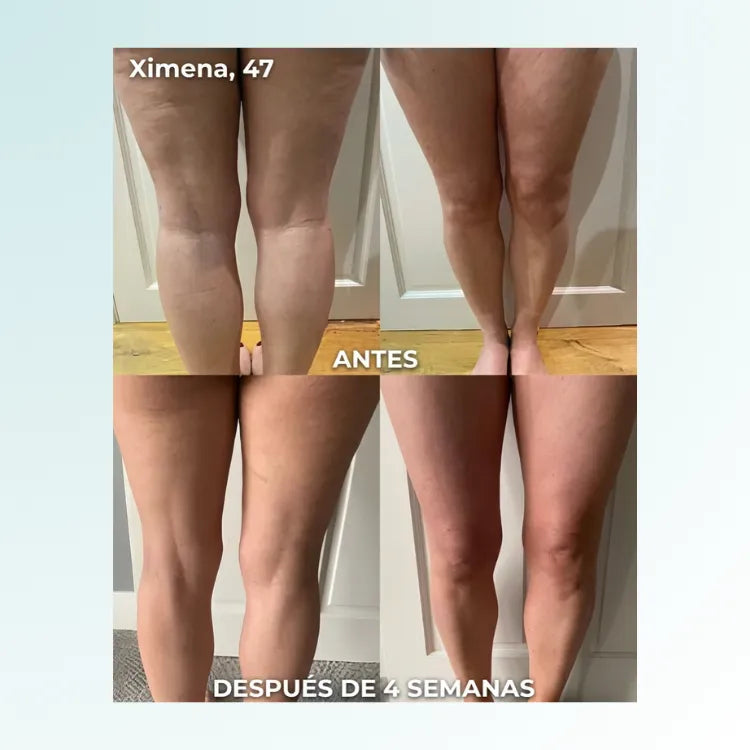 PlantarRelief™ –  Masajeador Tonificador EMS para Pies, Músculos y Cuerpo Alivio Premium