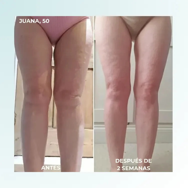 PlantarRelief™ –  Masajeador Tonificador EMS para Pies, Músculos y Cuerpo Alivio Premium