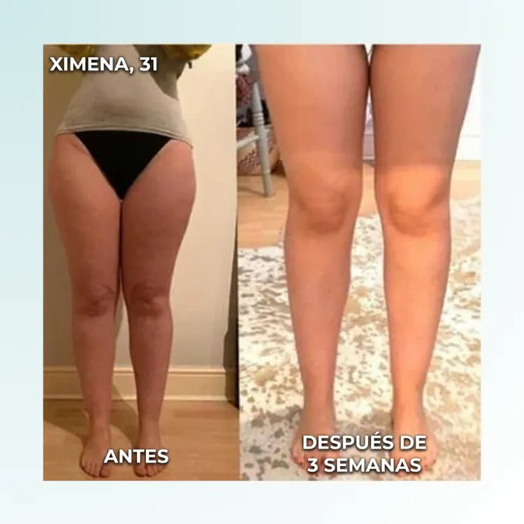 PlantarRelief™ –  Masajeador Tonificador EMS para Pies, Músculos y Cuerpo Alivio Premium