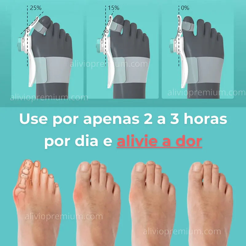 Corretor de Joanetes - Alívio Premium Alivio Premium