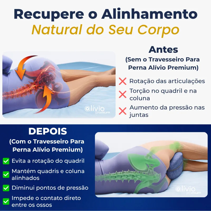 Travesseiro Para Perna - Alívio Premium Alivio Premium